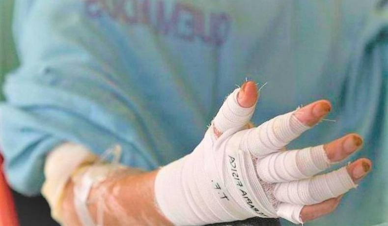 Noche de Navidad dejó tres personas quemadas por pólvora en Ibagué